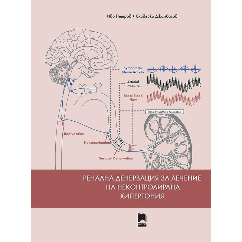 Ренална денервация за лечение на неконтролирана хипертония