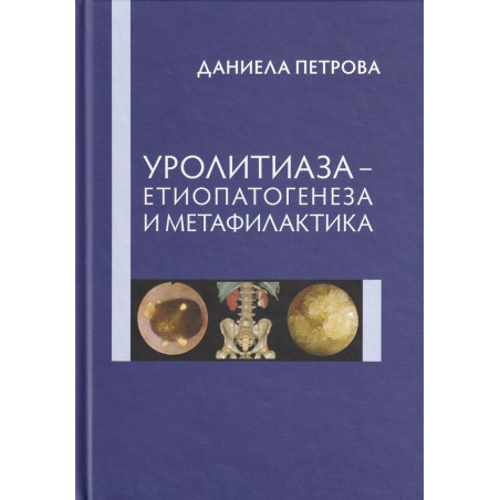 Уролитиаза - Етиопатогенеза и метафилактика