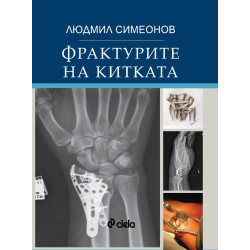 Фрактурите на китката