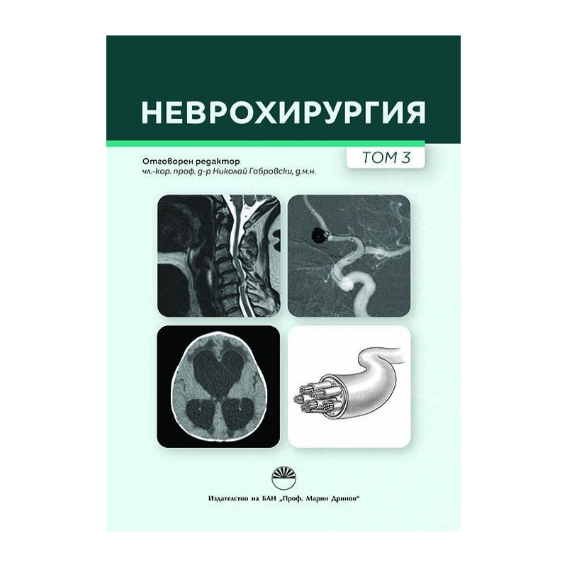 Неврохирургия