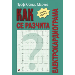 Как се разчита електрокардиограма