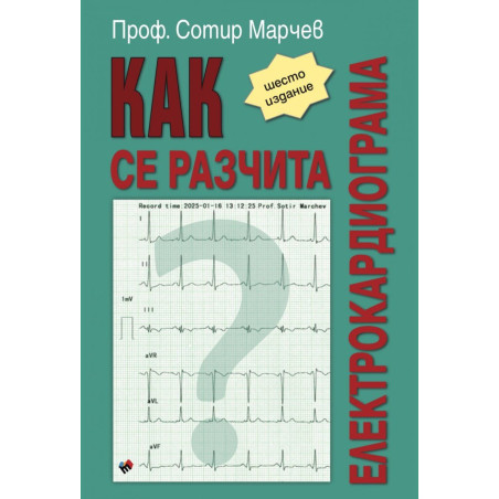 Как се разчита електрокардиограма